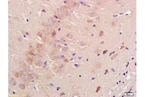 Formalin-fixed and paraffin embedded rat brain labeled with Anti-Contactin 3 Polyclonal Antibody, Unconjugated (ABIN761441) at 1:200 followed by conjugation to the secondary antibody and DAB staining (CNTN3 抗体  (AA 301-400))