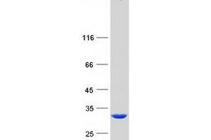 Western Blotting (WB) image for Glutathione S-Transferase theta 2 (GSTT2) protein (Myc-DYKDDDDK Tag) (ABIN2722021)