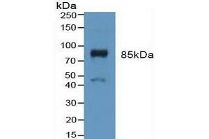 Detection of FGFR3 in Mouse Placenta Tissue using Polyclonal Antibody to Fibroblast Growth Factor Receptor 3 (FGFR3) (FGFR3 抗体  (AA 166-375))