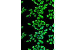 Immunofluorescence analysis of U2OS cells using NMT2 antibody (ABIN5974237). (NMT2 抗体)