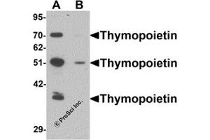 Western Blotting (WB) image for anti-Thymopoietin (TMPO) (N-Term) antibody (ABIN1031615) (Thymopoietin 抗体  (N-Term))