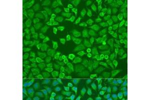 Immunofluorescence analysis of U2OS cells using EIF3A Polyclonal Antibody at dilution of 1:100. (EIF3A 抗体)