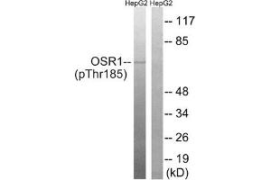 Western blot analysis of extracts from HepG2 cells treated with serum using OSR1 (Phospho-Thr185) Antibody. (OXSR1 抗体  (pThr185))