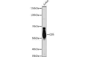 Western blot analysis of extracts of Jurkat cells, using CD5 antibody (ABIN7266206) at 1:1000 dilution.