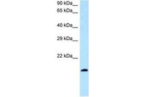 Image no. 1 for anti-Bone Marrow Stromal Cell Antigen 2 (BST2) (N-Term) antibody (ABIN6747353) (BST2 抗体  (N-Term))