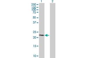 Western Blot analysis of SIRPD expression in transfected 293T cell line by SIRPD MaxPab polyclonal antibody. (SIRPD 抗体  (AA 1-197))