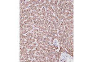 Immunohistochemical analysis of A on paraffin-embedded Human liver tissue. (Prohibitin 抗体  (N-Term))