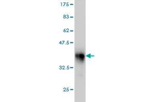 Western Blot detection against Immunogen (34. (LASS4 抗体  (AA 57-139))