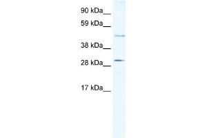 WB Suggested Anti-CASP3 Antibody Titration:  5ug/ml  Positive Control:  Human Liver (Caspase 3 抗体  (N-Term))