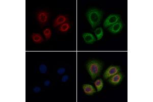 ABIN6262848 and ABIN6276891 staining Hela cells by IF/ICC. (Kallikrein 1 抗体  (Internal Region))