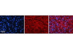 Rabbit Anti-GAMT Antibody    Formalin Fixed Paraffin Embedded Tissue: Human Adult liver  Observed Staining: Cytoplasmic Primary Antibody Concentration: 1:100 Secondary Antibody: Donkey anti-Rabbit-Cy2/3 Secondary Antibody Concentration: 1:200 Magnification: 20X Exposure Time: 0. (GAMT 抗体  (Middle Region))