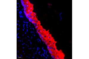 Immunofluorescence of paraffin embedded rat esophagus using CK13 (ABIN7074411) at dilution of 1:500 (400x lens) (Cytokeratin 13 抗体  (C-Term))