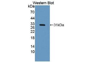 Western blot analysis of the recombinant protein. (IGFBP4 抗体  (AA 22-258))
