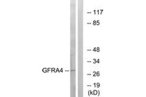 Western blot analysis of extracts from HeLa cells, using GFRA4 Antibody. (GFRA4 抗体  (AA 141-190))