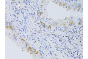 Immunohistochemistry of paraffin-embedded mouse lung using CYP2C9 Antibody (ABIN5973660) at dilution of 1/100 (40x lens). (CYP2C9 抗体)