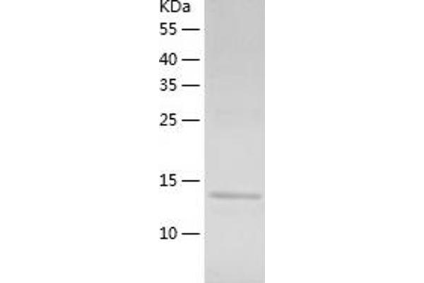 ZNF697 Protein (AA 1-136) (His tag)