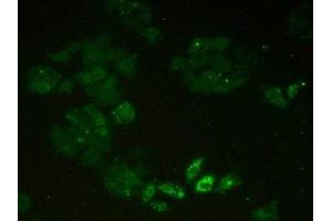 Detection of MCM2 in Human Hela Cells using Polyclonal Antibody to Minichromosome Maintenance Deficient 2 (MCM2) (Minichromosome Maintenance Deficient 2 (AA 473-679) 抗体)