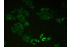 Immunohistochemistry (IHC) image for anti-Minichromosome Maintenance Complex Component 2 (MCM2) (AA 473-679) antibody (ABIN7434038)