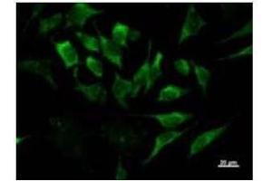 Immunostaining analysis in HeLa cells. (IRF3 抗体)