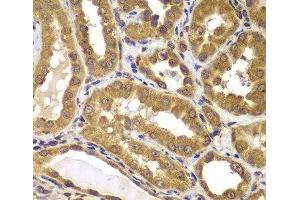 Immunohistochemistry of paraffin-embedded Human kidney using PSEN2 Polyclonal Antibody at dilution of 1:100 (40x lens). (Presenilin 2 抗体)