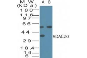 Image no. 1 for anti-Voltage-Dependent Anion Channel 2/3 (VDAC2/3) (AA 120-132) antibody (ABIN960406) (VDAC2/3 抗体  (AA 120-132))