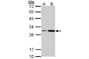 WB Image Sample (30 ug of whole cell lysate) A: Molt-4 , B: Raji 12% SDS PAGE antibody diluted at 1:1000 (NQO1 抗体  (C-Term))