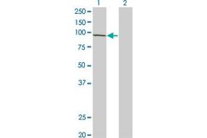 Western Blot analysis of CSDE1 expression in transfected 293T cell line by CSDE1 polyclonal antibody (A01). (CDSE1 抗体  (AA 670-765))