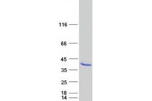 Western Blotting (WB) image for Apolipoprotein L, 2 (APOL2) protein (Myc-DYKDDDDK Tag) (ABIN2714840)