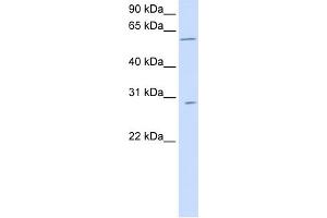WB Suggested Anti-PNPLA4 Antibody Titration:  0. (PNPLA4 抗体  (C-Term))