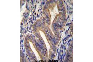 METTL10 Antibody (N-term) immunohistochemistry analysis in formalin fixed and paraffin embedded human uterus tissue followed by peroxidase conjugation of the secondary antibody and DAB staining. (METTL10 抗体  (N-Term))