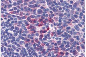 Mouse Spleen: Formalin-Fixed, Paraffin-Embedded (FFPE) (IL-10 抗体)