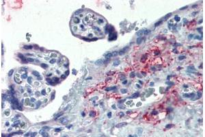 Placenta: Formalin-Fixed, Paraffin-Embedded (FFPE) (ERP44 抗体  (Internal Region))