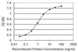 Detection limit for recombinant GST tagged MACF1 is 0. (MACF1 抗体  (AA 1-95))