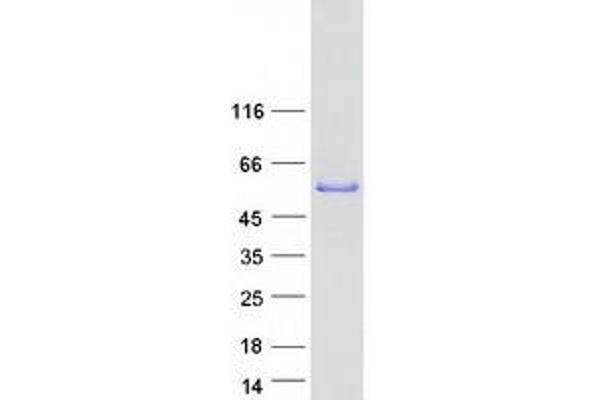 CERKL Protein (Transcript Variant 1) (Myc-DYKDDDDK Tag)