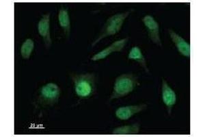 Immunostaining analysis in HeLa cells. (ISL2 抗体)