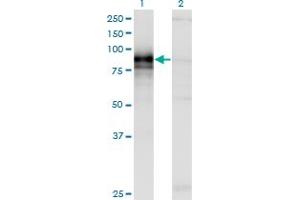 Western Blotting (WB) image for anti-Hedgehog Interacting Protein (HHIP) (AA 21-121) antibody (ABIN466235) (HHIP 抗体  (AA 21-121))