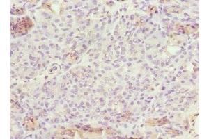 Immunohistochemistry of paraffin-embedded human pancreatic tissue using ABIN7151902 at dilution of 1:100 (EPS15L1 抗体  (AA 585-864))