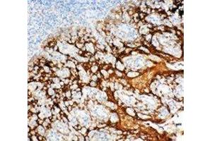 Anti-14-3-3 sigma antibody, IHC(P) IHC(P): Human Tonsil Tissue (14-3-3 sigma/SFN 抗体  (Middle Region))