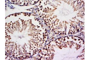 Paraformaldehyde-fixed, paraffin embedded mouse testis tissue, Antigen retrieval by boiling in sodium citrate buffer(pH6) for 15min, Block endogenous peroxidase by 3% hydrogen peroxide for 30 minutes, Blocking buffer (normal goat serum) at 37°C for 20min, Antibody incubation with Rabbit Anti-NEK9 Polyclonal Antibody, Unconjugated  at 1:500 overnight at 4°C, followed by a conjugated secondary and DAB staining (NEK9 抗体)
