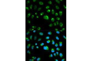 Immunofluorescence analysis of HeLa cell using TLR1 antibody. (TLR1 抗体  (AA 30-290))