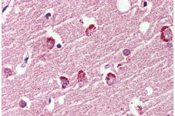 G Protein-Coupled Receptor 119 抗体  (Cytoplasmic Domain)
