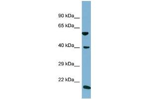 Host:  Rabbit  Target Name:  SLC2A10  Sample Type:  NCI-H226 Whole Cell lysates  Antibody Dilution:  1.