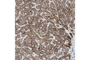 Immunohistochemical staining of human liver shows strong cytoplasmic positivity in hepatocytes. (PRELID1 抗体)