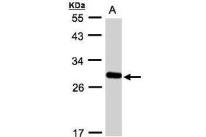 WB Image Sample(30 ug whole cell lysate) A:A431, 12% SDS PAGE antibody diluted at 1:1000 (YIPF4 抗体)