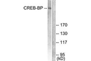 Western blot analysis of extracts from HeLa cells, treated with Insulin 0. (CBP 抗体  (AA 2393-2442))