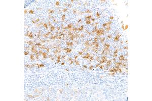 Immunohistochemistry (IHC) image for anti-Indoleamine 2,3-Dioxygenase 1 (IDO1) (AA 1-403) antibody (ABIN7449541) (Recombinant IDO1 抗体  (AA 1-403))