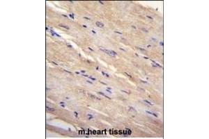 FB Antibody (N-term) (ABIN655226 and ABIN2844832) immunohistochemistry analysis in formalin fixed and paraffin embedded human m. (FAM69B 抗体  (N-Term))