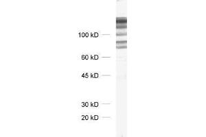 dilution: 1 : 1000, sample: crude synaptosomal fraction of rat brain (P2) (DLG1 抗体)