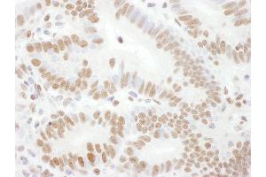 anti-RAD17 (RAD17) (pSer645) antibody