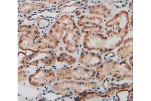 Used in DAB staining on fromalin fixed paraffin- embedded kidney tissue (KRT9 抗体  (AA 315-456))